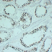 Topoisomerase 2 alpha Mouse Monoclonal Antibody