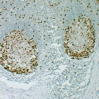 Topoisomerase 2 alpha Mouse Monoclonal Antibody