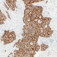 Cadherin pan Mouse Monoclonal Antibody