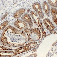 Cadherin pan Mouse Monoclonal Antibody