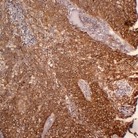 Cytokeratin 5 Mouse Monoclonal Antibody