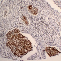 Cytokeratin 5 Mouse Monoclonal Antibody