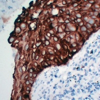 Cytokeratin 5 Mouse Monoclonal Antibody