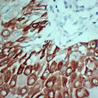 Cytokeratin 5 Mouse Monoclonal Antibody