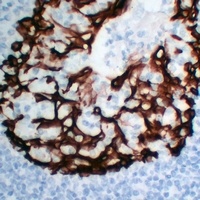 Cytokeratin 5 Mouse Monoclonal Antibody