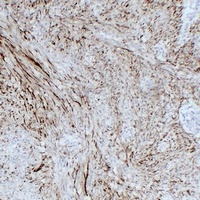 GFAP Mouse Monoclonal Antibody