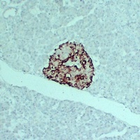 TIMP1 Mouse Monoclonal Antibody