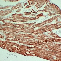 Actin Sarcomeric Muscle Mouse Monoclonal Antibody