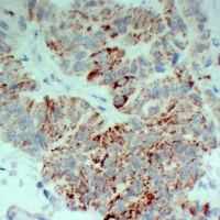 TGFBR2 Mouse Monoclonal Antibody