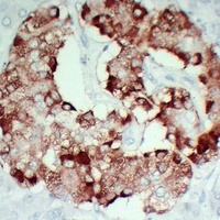 TIMP1 Mouse Monoclonal Antibody