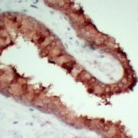 TIMP1 Mouse Monoclonal Antibody