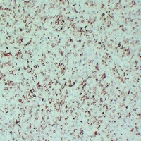STMN1 Mouse Monoclonal Antibody