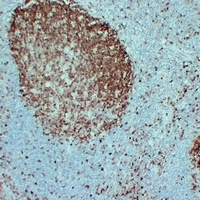 STMN1 Mouse Monoclonal Antibody