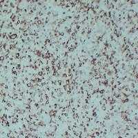 STMN1 Mouse Monoclonal Antibody