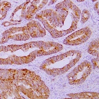 Catenin delta 1 Mouse Monoclonal Antibody