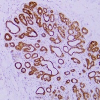 Catenin delta 1 Mouse Monoclonal Antibody