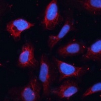 ANO1 Rabbit Polyclonal Antibody