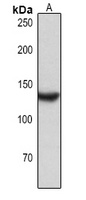 CD31 Rabbit Polyclonal Antibody
