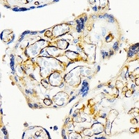 CD31 Rabbit Polyclonal Antibody