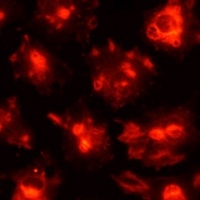 CD31 Rabbit Polyclonal Antibody