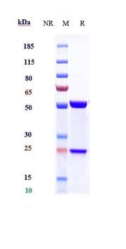 IL-21 Antibody
