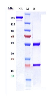 IGF1-R/IGFR1/CD221 Antibody