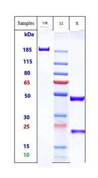 IgE Antibody