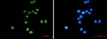p53 Rabbit mAb Antibody