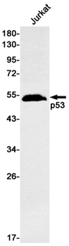 p53 Rabbit mAb Antibody
