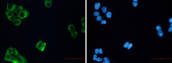beta III Tubulin Rabbit mAb Antibody