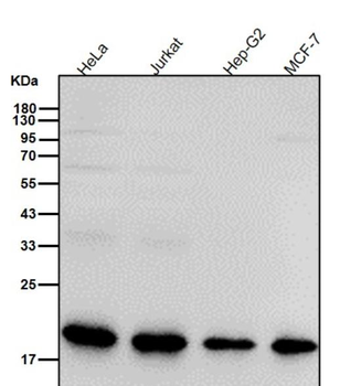 Superoxide Dismutase 1 Rabbit Monoclonal Antibody