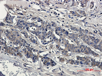 Superoxide Dismutase 1 Rabbit Monoclonal Antibody
