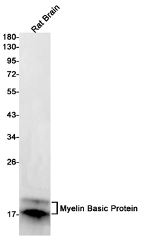 Myelin Basic Protein Rabbit mAb Antibody