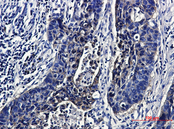 IGF1 Receptor Rabbit Monoclonal Antibody