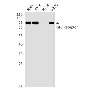 IGF1 Receptor Rabbit Monoclonal Antibody