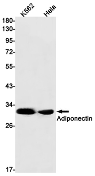 Adiponectin Rabbit mAb Antibody