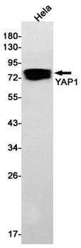 YAP1 Rabbit mAb Antibody