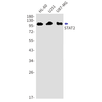 STAT2 Rabbit mAb Antibody