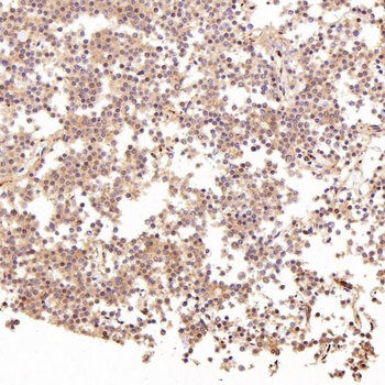 LRP1 Rabbit Monoclonal Antibody