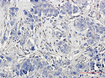 LRP1 Rabbit Monoclonal Antibody