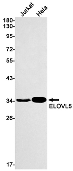 ELOVL5 Rabbit Monoclonal Antibody