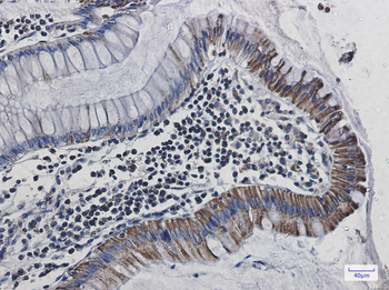 Cytochrome C Oxidase subunit Vic Rabbit mAb Antibody
