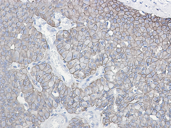 E Cadherin (Phospho-Ser838/Ser840) Rabbit mAb Antibody