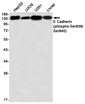E Cadherin (Phospho-Ser838/Ser840) Rabbit mAb Antibody