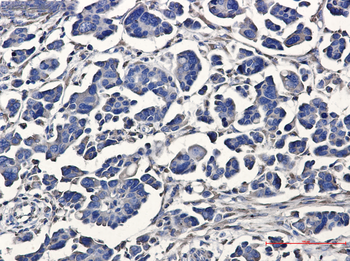 ATE1 Rabbit mAb Antibody