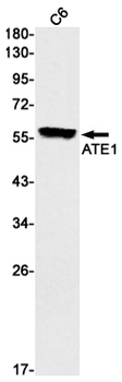 ATE1 Rabbit mAb Antibody