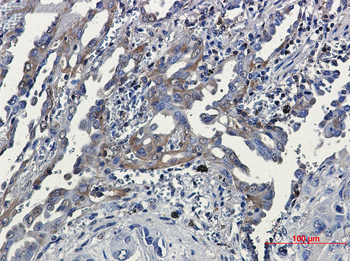 RSK3 Rabbit Monoclonal Antibody
