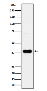 CXCR6 / CD186 Rabbit mAb Antibody