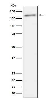 ErbB2(Phospho-Tyr1221/Tyr1222) mA Rabbit Monoclonal Antibody