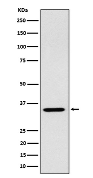 ARPC2 Rabbit mAb [KD Validated] Antibody